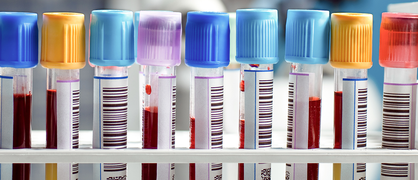 Cost management strategies for clinical laboratories